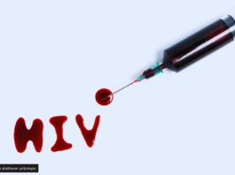 Avance revolucionario contra el VIH: Un Solo Pinchazo Anual para la Prevención Inyección VIH